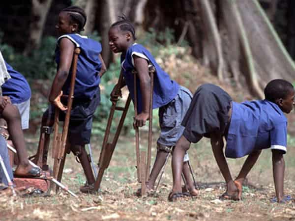 Polio-Children