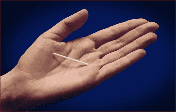 contraception-contraceptive-implant