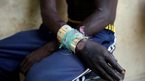 A member of the local militia group, otherwise known as CJTF, Dala Ishami Angwala, who was injured during a gun battle with Boko Haram, sits for a portrait photograph in a compound in Maiduguri