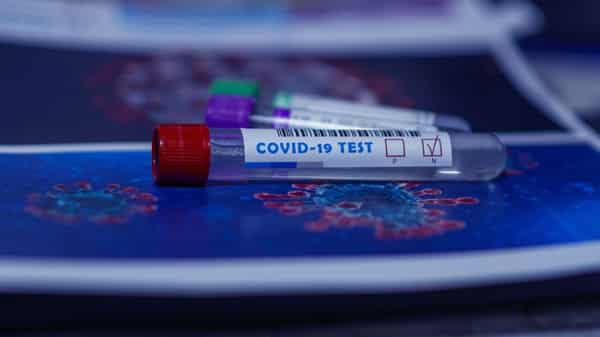 COVID-19-test-kits