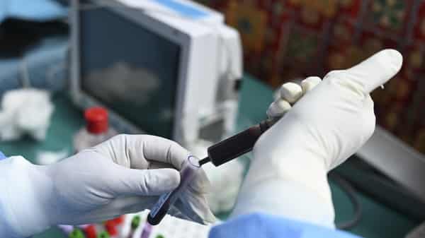 INDIA-KASHMIR-HEALTH-VIRUS