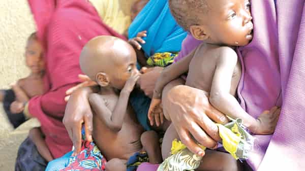 Malnourished Children