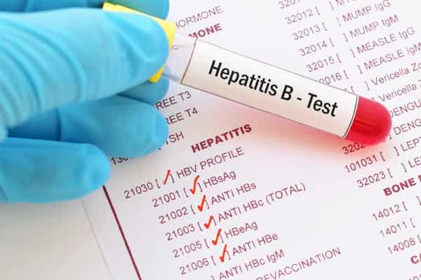 Hepatitis B Test
