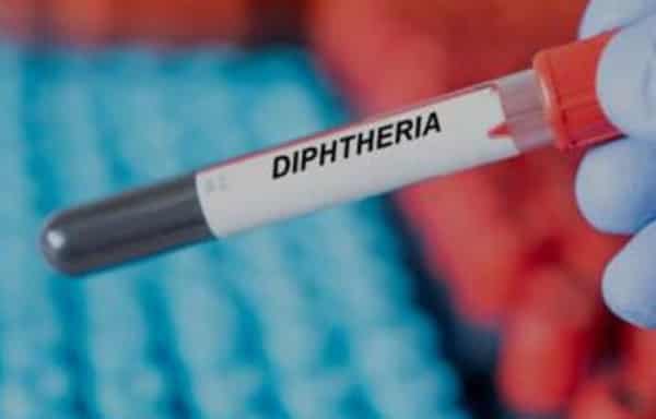 Diphtheria-e1690812279127-350×250