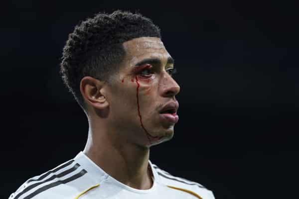 FBL-ESP-LIGA-REAL MADRID-CELTA VIGO