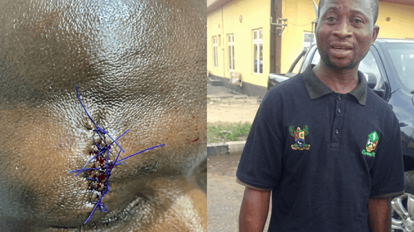 Some assaulted KAI officials