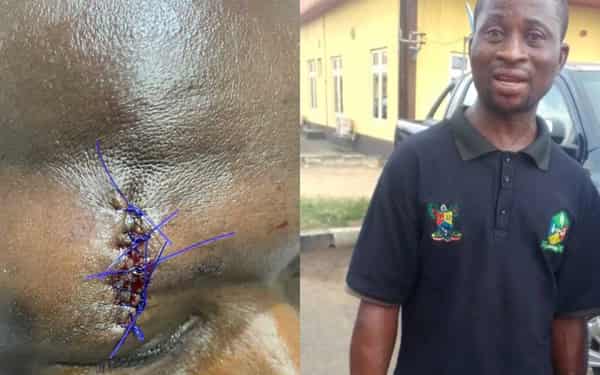 Wounded-KAI-officials