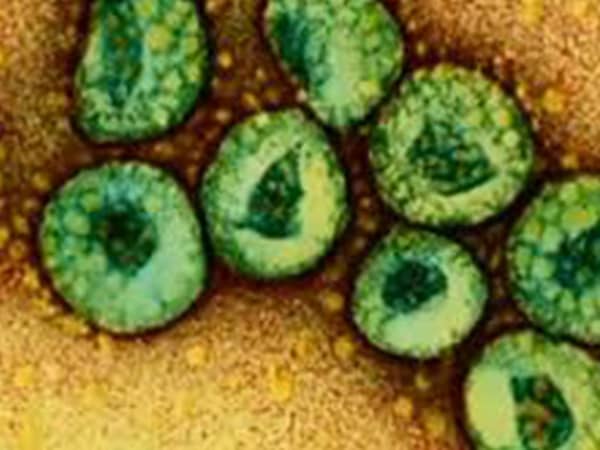 MERS virus
