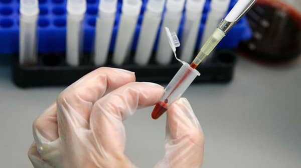 A-laboratory-technician-examines-blood-samples-for-HIVAIDS-in-a-public-hospital-in-Valparaiso-city