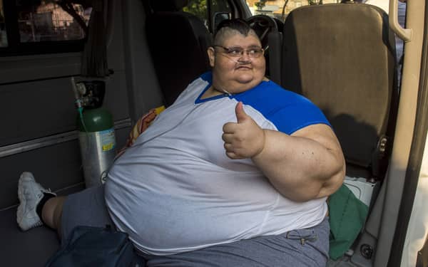 MEXICO-OBESITY-FRANCO