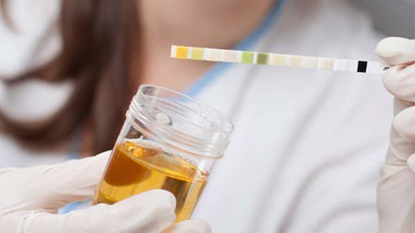 test-urine
