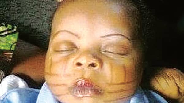 Incision-tribal-mark