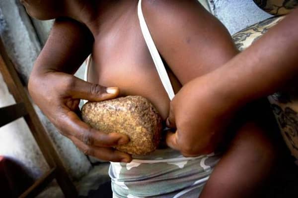 BG8390 Breast ironing with hot stone, Douala, Cameroon.