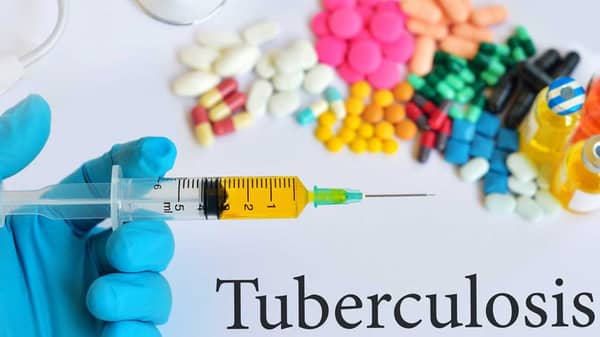 Tuberculosis