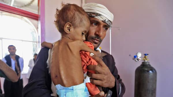 Yemen Food Crisis