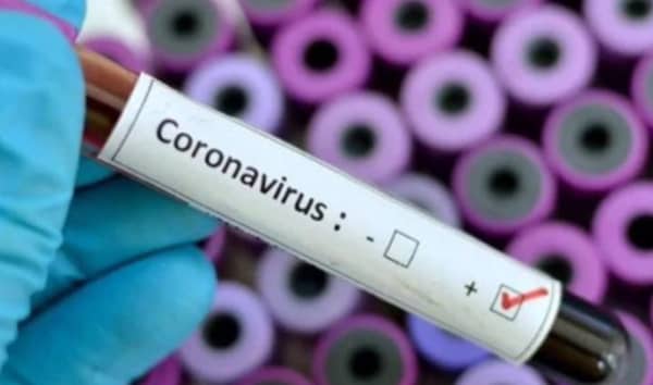 Coronavirus-2-4-727×430