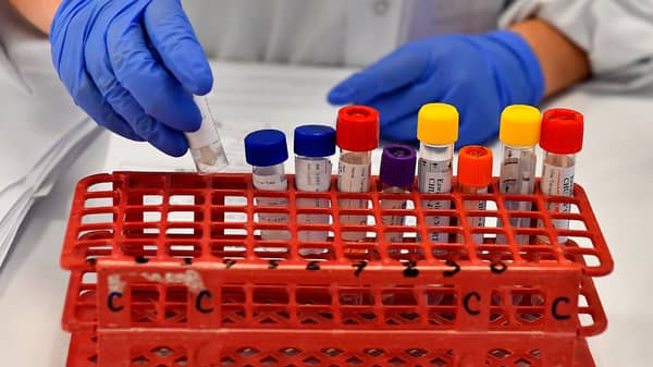 FRANCE-HEALTH-VIRUS-SCREENING-HOSPITAL