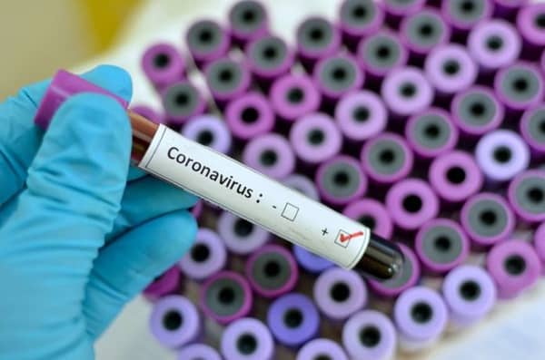 Coronavirus-Test