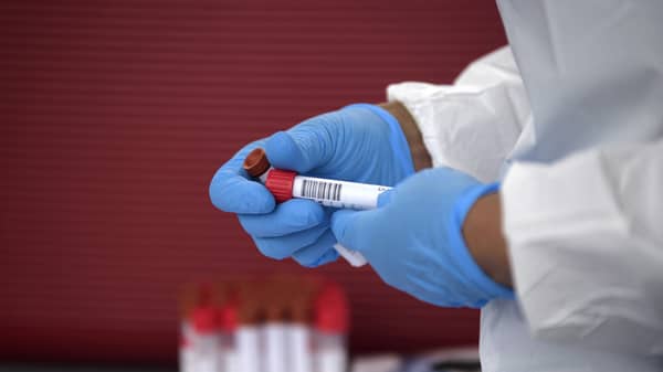 US-HEALTH-VIRUS-TESTING