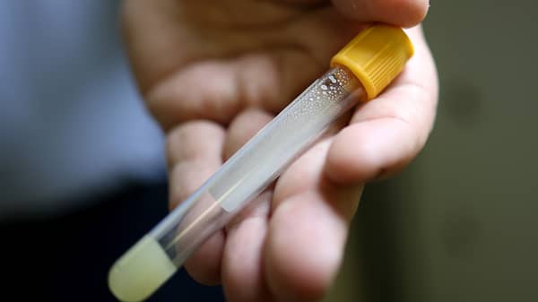 Washington DC District Government Offers Free Antibody Tests For COVID-19