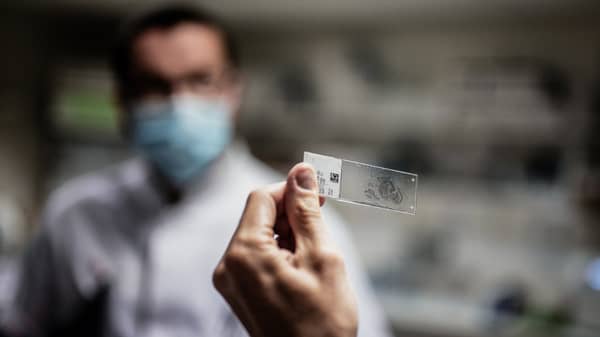 FRANCE-HEALTH-SCIENCE-CANCER