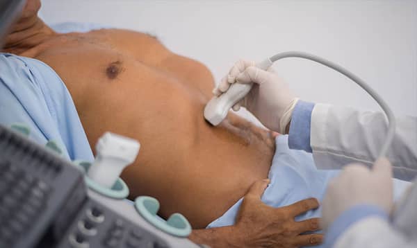 Testicular cancer. Photo iuslondon