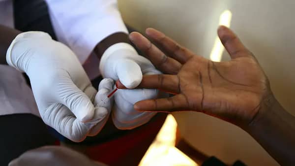 HIV test
