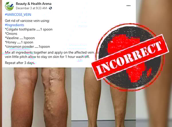 varicose_incorrect-768×569