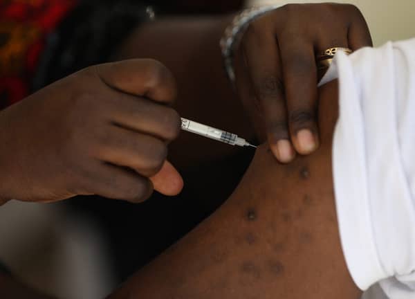NIGERIA-HEALTH-VIRUS-VACCINE