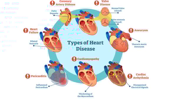Cardiovascular-Disease