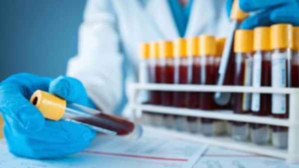 Blood tests