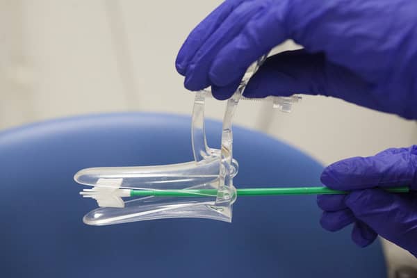 CERVICAL-SCREENING-EQUIPMENT-Jos-cervical-cancer-trust