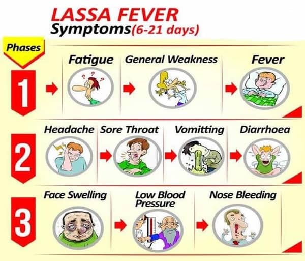 Symptoms-of-LASSA-Fever