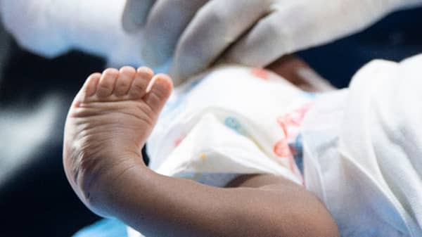 Newborn with club foot