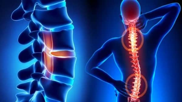 detail-main-spine-disorders