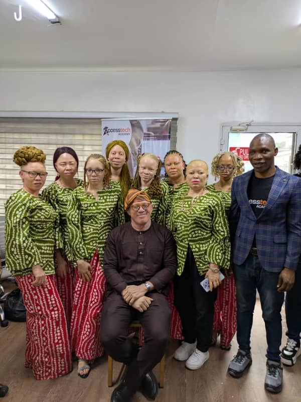 Accesstech=beauty queens with albinism