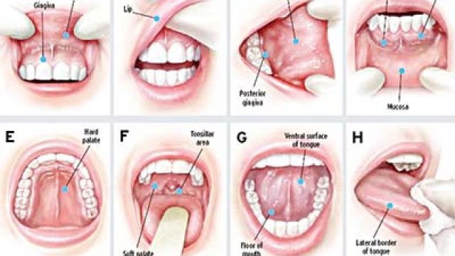 Oral sex raises risk of getting cancer by 22% | The Guardian ...