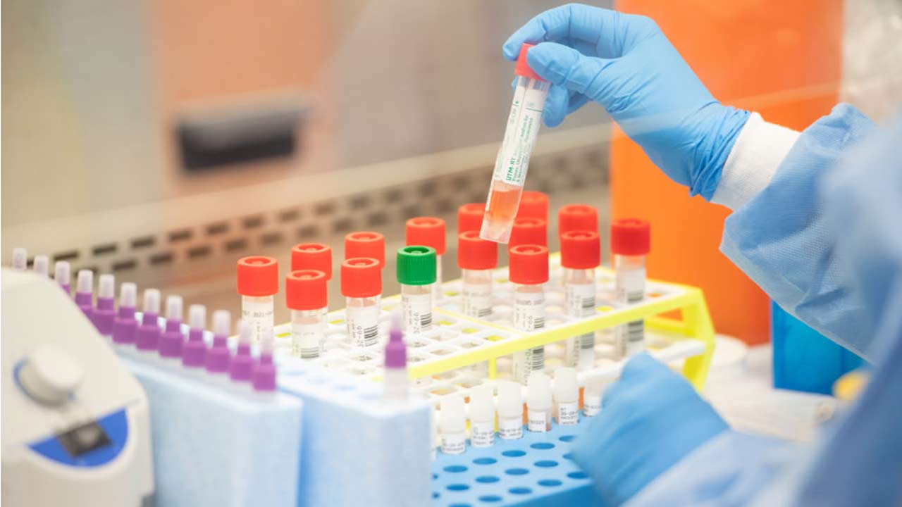 New test kits raise hope for COVID-19 fight | The Guardian Nigeria News ...