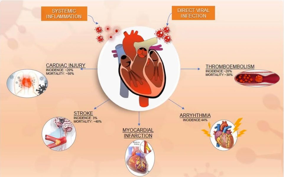 Most Common Symptoms Of Six Cardiovascular Diseases — Features — The ...